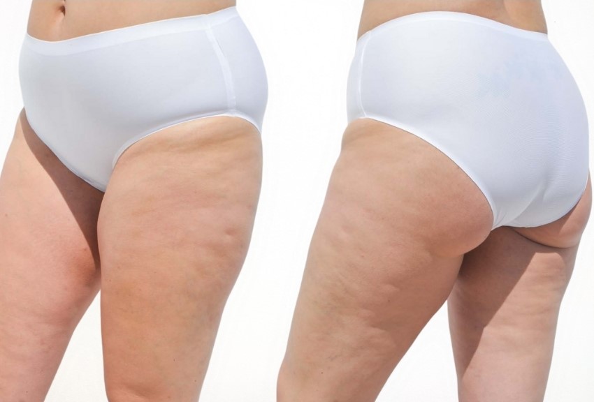 UNIVERSAL MAXIMA CORTE LASER